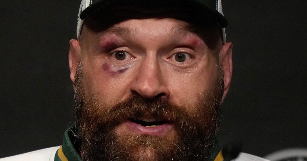 Tyson Fury anunció, otra vez, su retiro del boxeo y dejó un mensaje enigmático: "Dick Turpin llevaba una máscara"