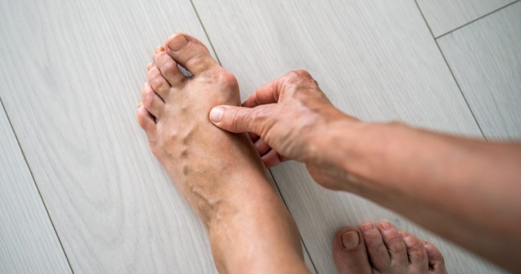 Desde juanetes a dedos en garra y fascitis plantar: 4 claves para elegir un buen calzado y evitar problemas