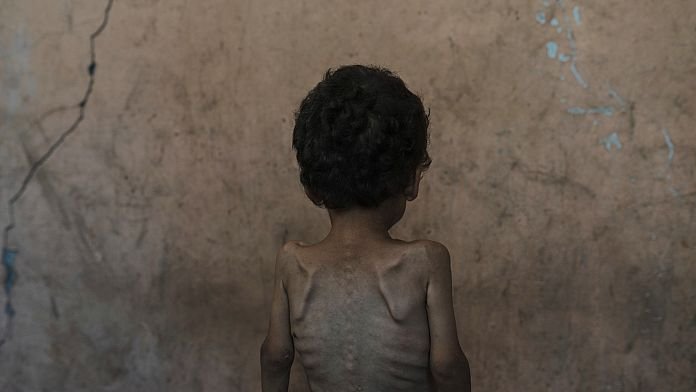 Llegan a España 13 niños gazatíes enfermos para recibir tratamiento hospitalario