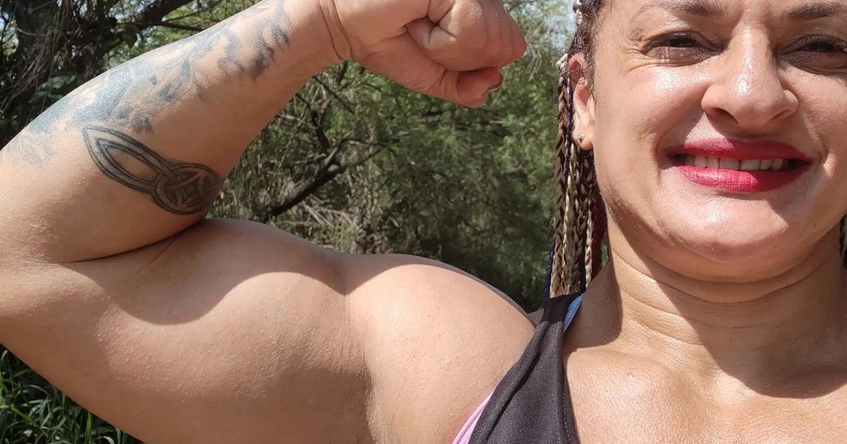 Qué es un ACV isquémico, el episodio que derivó en la muerte de Alejandra "Locomotora" Oliveras