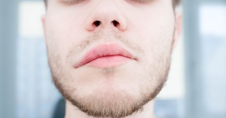 Qué es un ACV isquémico, el episodio que sufrió Locomotora Oliveras