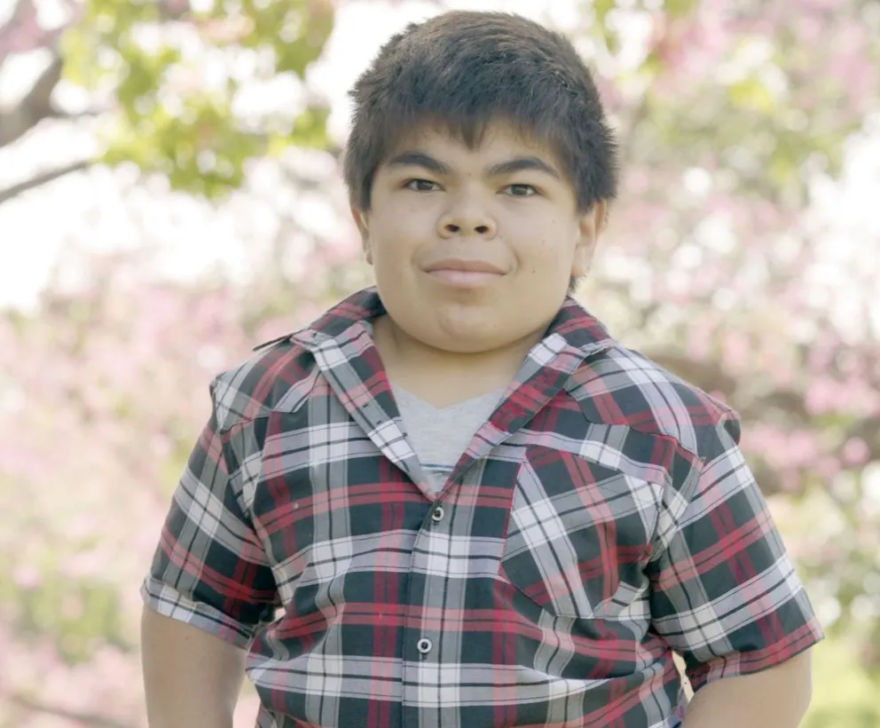 En la Argentina, 1 de cada 2 niños con mucopolisacaridosis  necesitó más de 10 visitas médicas para llegar al diagnóstico