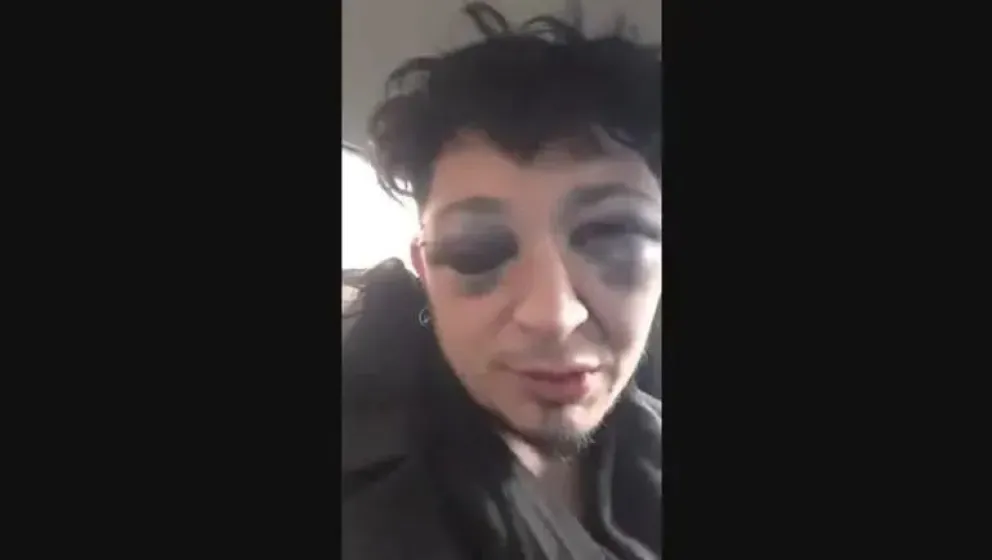 Policías separados tras propinarle una golpiza a un músico en Pico Truncado