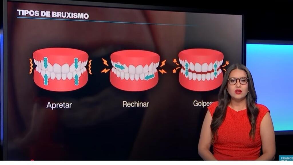 El bruxismo y las implicaciones de rechinar o apretar los dientes