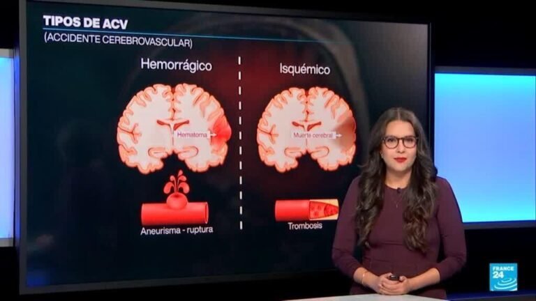 ¿Podemos prevenir un ataque cerebrovascular?