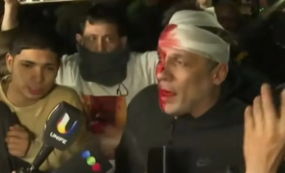 Un periodista terminó con la cara ensangrentada en el acto de Milei