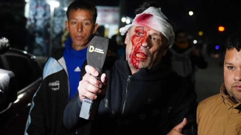 Brutal agresión a un periodista de América TV