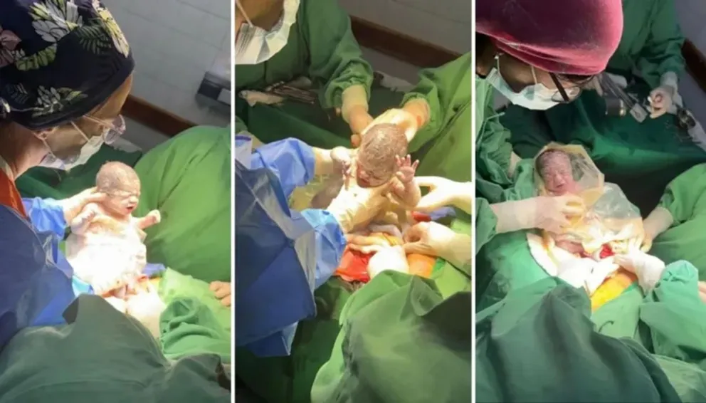 Nacieron trigemelas en Salta