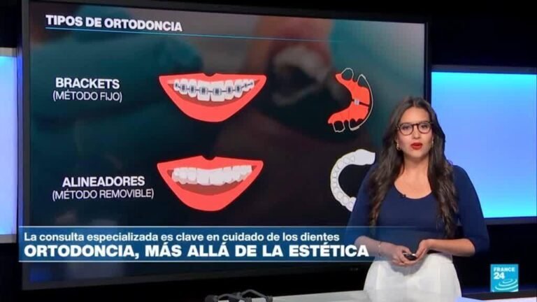 Precauciones para tener en cuenta si busca una "sonrisa perfecta"