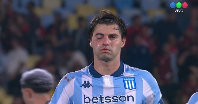 Santiago Sosa quedó con el ojo como un boxeador por un codazo de Marcos Rojo en la semifinal de la Libertadores de Flamengo vs Racing