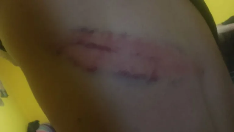 Denuncian que efectivos policiales ingresaron a su casa y los atacaron brutalmente