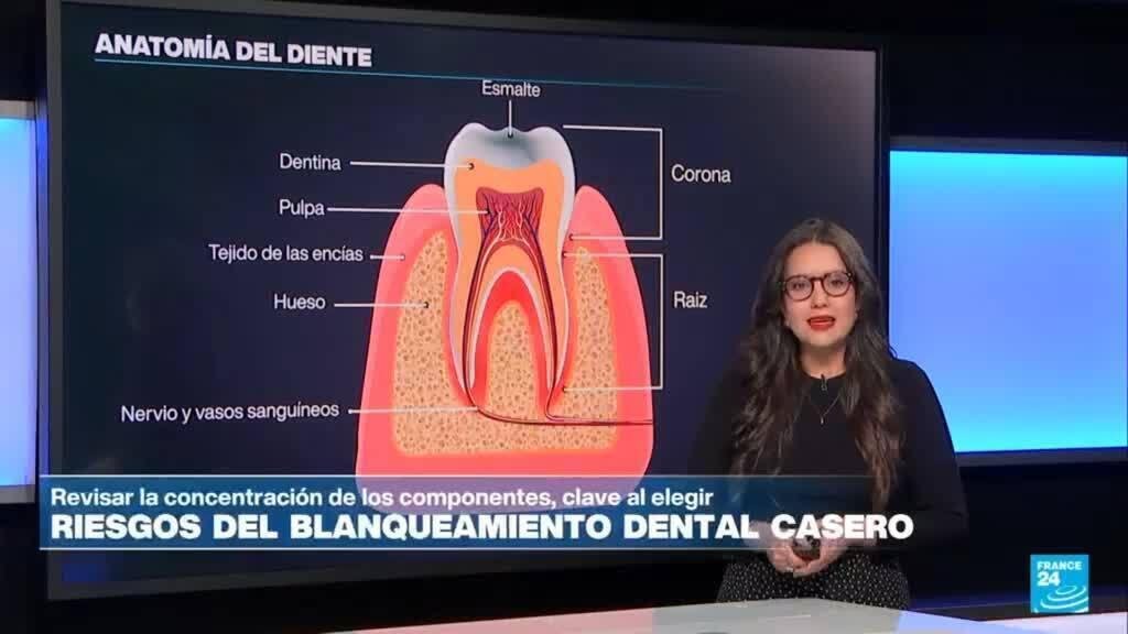 Los riesgos del blanqueamiento dental casero