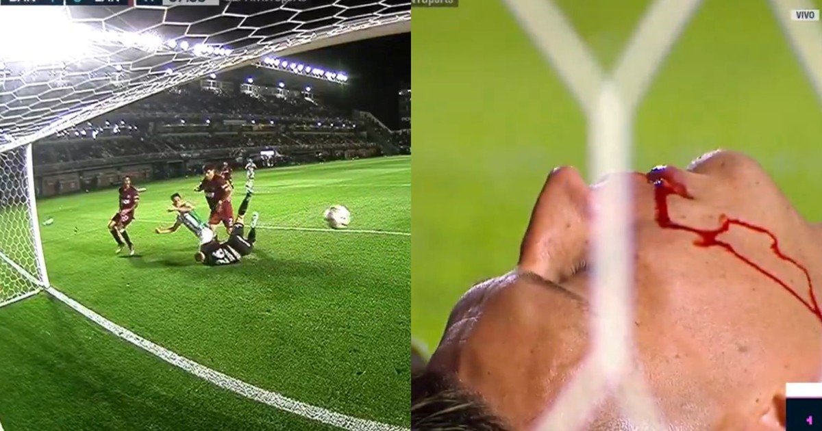 Video: el impactante corte en el rostro del arquero Losada en el gol de Banfield