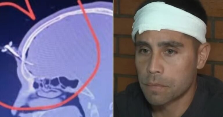 Habló el jugador del Ascenso que le clavaron una llave en la cabeza: "No sabían si podían salvarme, por suerte lo puedo contar"