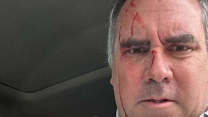 Tirotean a Rafael Belaunde Llosa, candidato presidencial en Perú