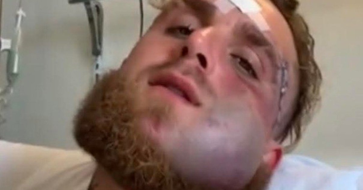 Jake Paul mostró cómo tiene la cara a cinco días del nocaut de Anthony Joshua que le destruyó la mandíbula