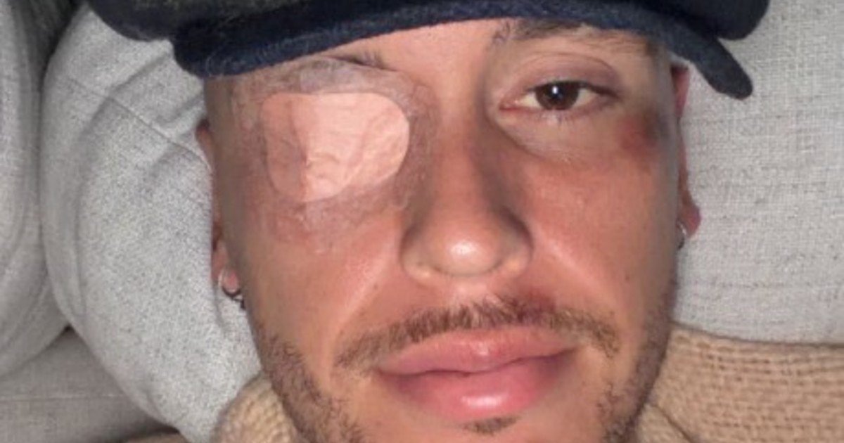 El delicado momento de salud de Lucas Ocampos: tras fracturarse, sufrió una parálisis facial y se pierde la pretemporada en México