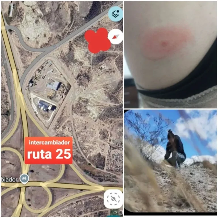 Apareció un caso extraño vinculado con la enfermedad de la garrapata