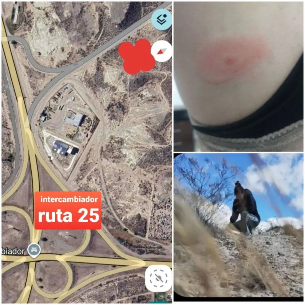 Apareció un caso extraño vinculado con la enfermedad de la garrapata