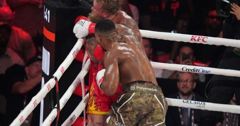 La radiografía que muestra la "doble mandíbula rota" de Jake Paul tras el brutal nocaut de Anthony Joshua