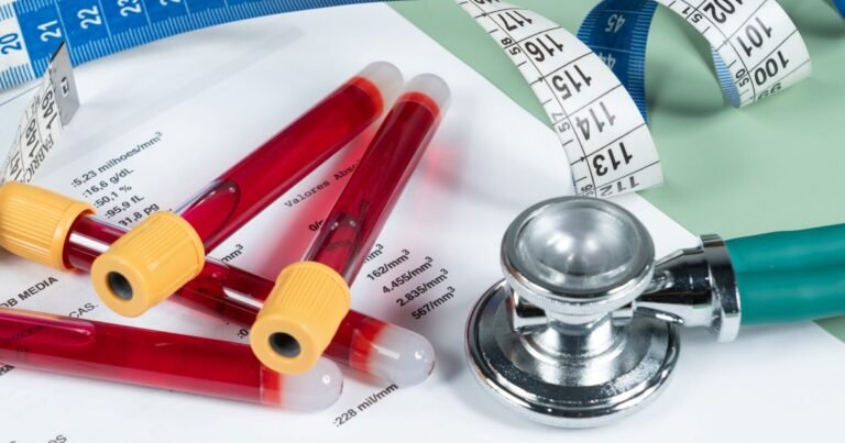 Infarto y ACV "avisan" siempre con tiempo, según un estudio: 4 factores clásicos que los anteceden