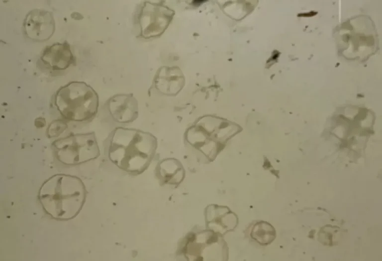 Detectaron medusas exóticas en lagos de Bariloche y alertan por su impacto ambiental