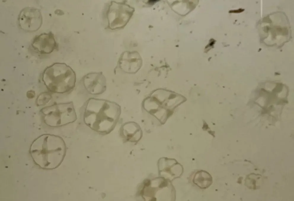 Detectaron medusas exóticas en lagos de Bariloche y alertan por su impacto ambiental