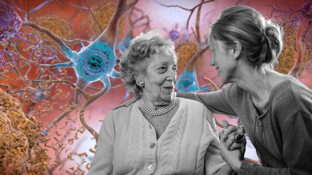 ¿Qué tienen en común la menopausia y el alzheimer?
