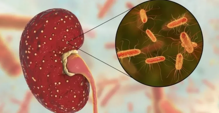 Comodoro se mantiene libre de casos de Síndrome Urémico Hemolítico y alerta sobre cuidados