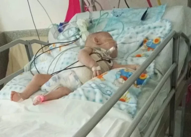 Cuando parecía estabilizarse, el bebé de Las Heras con síndrome de Prune Belly volvió a descompensarse