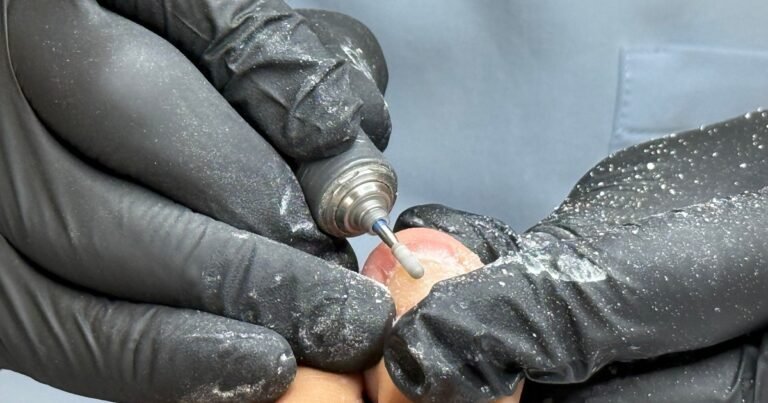 "El pie habla y nos da varias alertas": todo lo que puede revelar una visita al podólogo