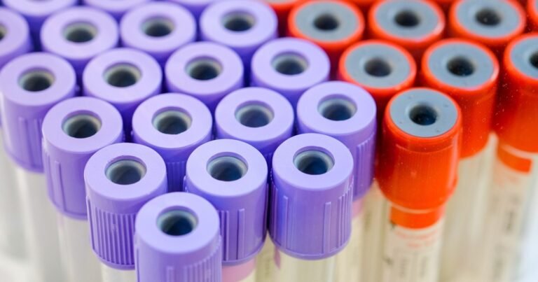 Homocisteína alta, un indicador de riesgo cardiovascular: cuándo, por qué y en quiénes medirla