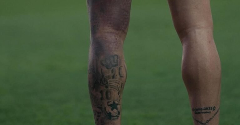 La impactante imagen del moretón de Rodrigo De Paul: ¿llega al amistoso de la Selección en la Bombonera?