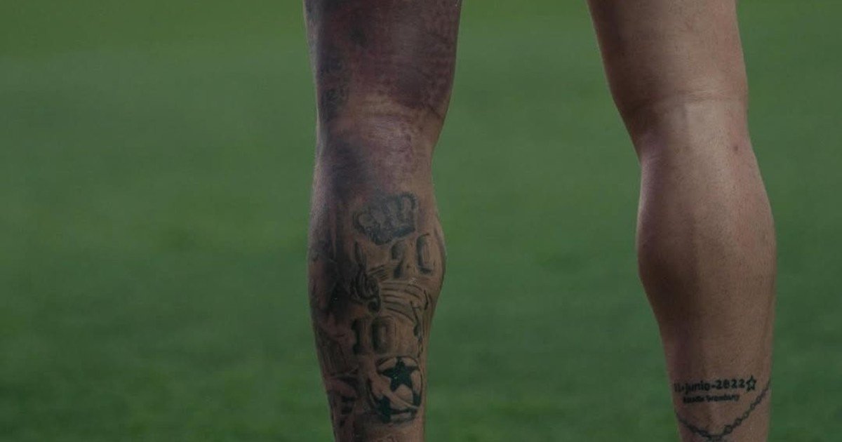 La impactante imagen del moretón de Rodrigo De Paul: ¿llega al amistoso de la Selección en la Bombonera?