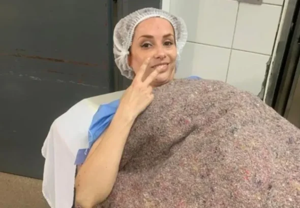 La admirable lucha de Eliana, la mendocina que pidió que le amputaran la pierna para dejar de sufrir