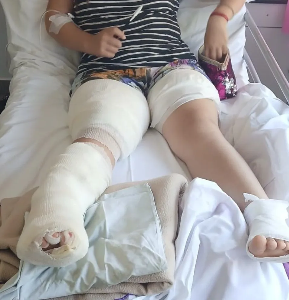 Su hija se quemó con agua caliente y necesitan una silla de ruedas para su traslado