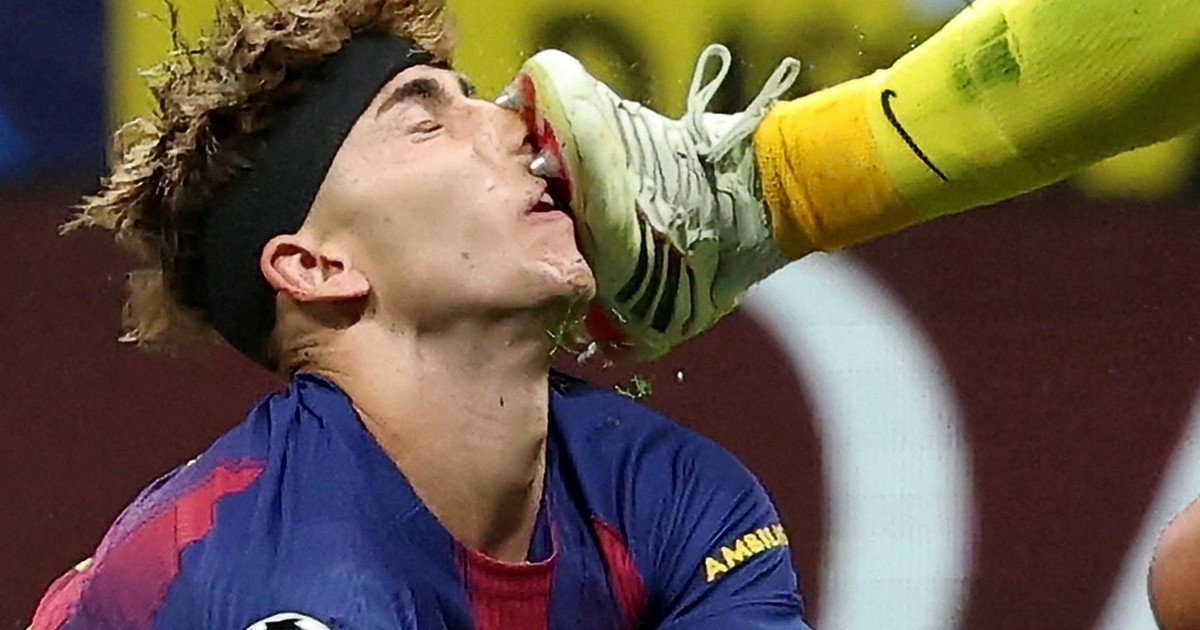 La foto más estremecedora del partidazo de Champions entre Atlético de Madrid y Barcelona: los tapones de Juan Musso sobre Fermín