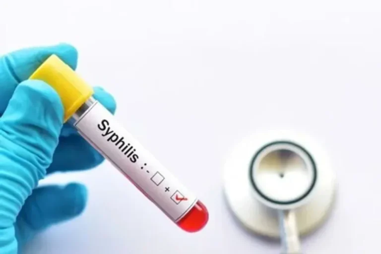Confirmaron más de 46.000 casos de sífilis durante el último año en Argentina