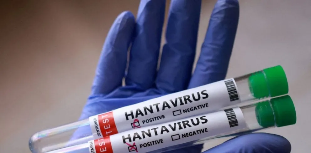 Investigadoras del Malbrán confirman que una droga contra el Covid frena el hantavirus