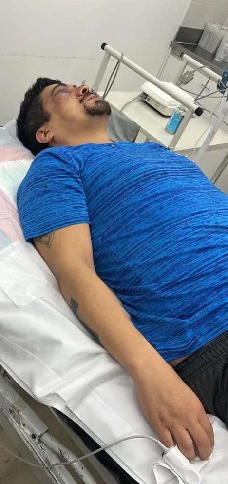 Franco Alí González, herido en el crimen de un comerciante de Bariloche está fuera de peligro