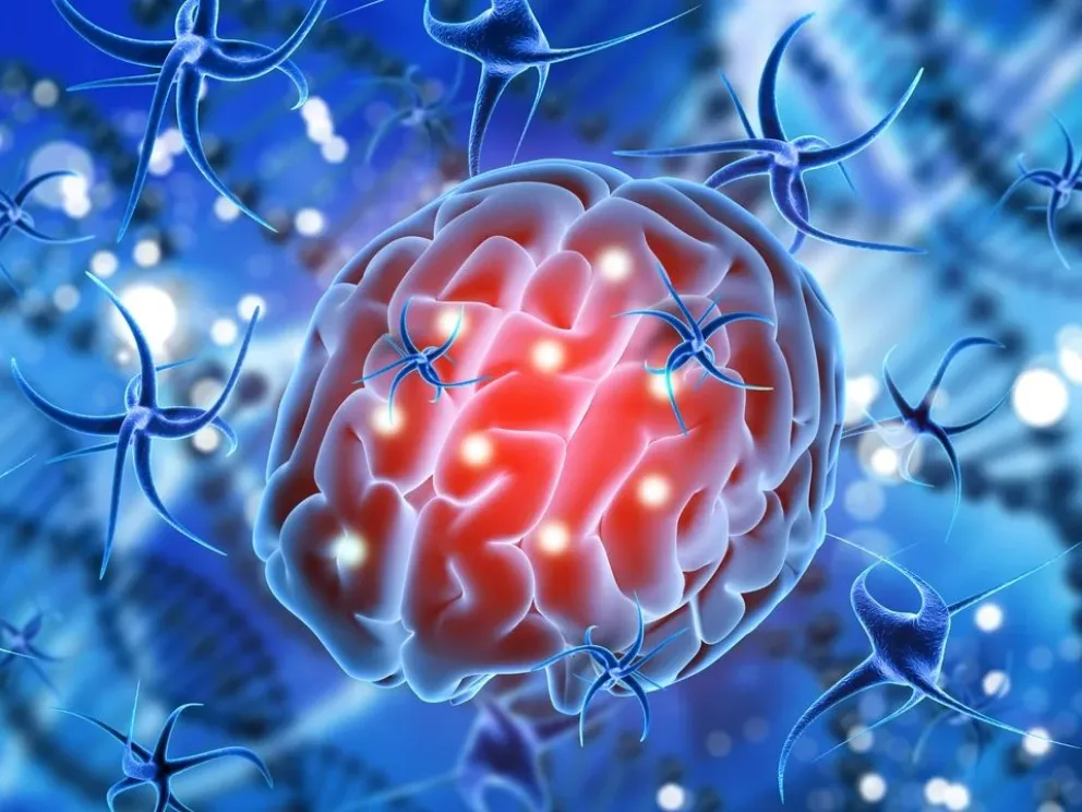 Innovación en neurooncología: llega al país terapia contra tumores cerebrales